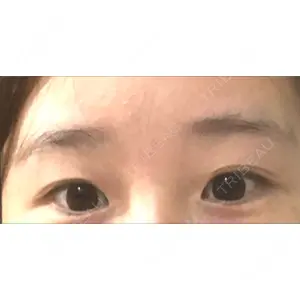 TCB東京中央美容外科 TCB東京中央美容外科 渋谷東口院口コミ