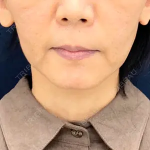 口コミ