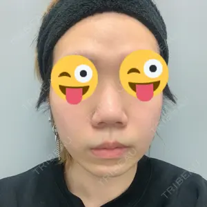 TCB東京中央美容外科 TCB東京中央美容外科 渋谷東口院口コミ