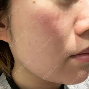 Zetith Beauty Clinic Zetith Beauty Clinic 銀座院口コミ