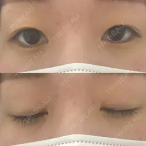 TCB東京中央美容外科 TCB東京中央美容外科 新宿三丁目院口コミ