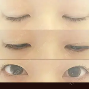 表参道スキンクリニック 表参道スキンクリニック 表参道院口コミ