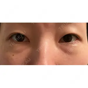 JBCジュノビューティークリニック 新宿三丁目院口コミ