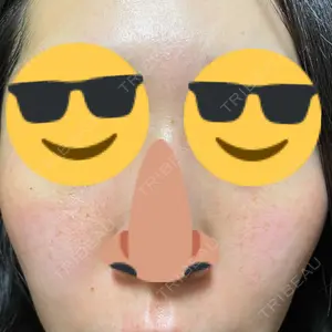 南青山TOKUNAKAクリニック口コミ