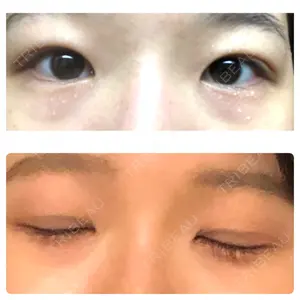 東京BELLEZZAクリニック口コミ