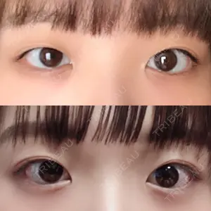 口コミ