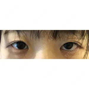口コミ