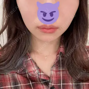 TCB東京中央美容外科 TCB東京中央美容外科 新宿東口院口コミ