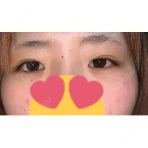 湘南美容クリニック 湘南美容クリニック 池袋東口院口コミ