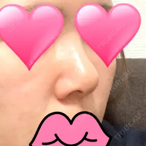サラ美容外科口コミ