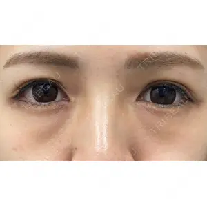 APOLLO BEAUTY CLINIC口コミ