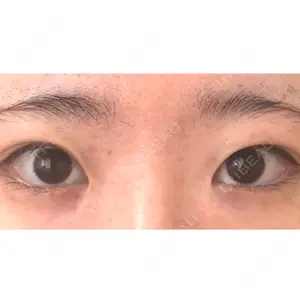 いちのせ形成外科・皮膚科 眼瞼＆フェイスクリニック口コミ