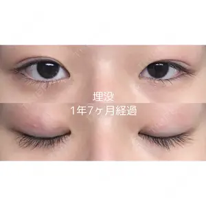 サラ美容外科口コミ