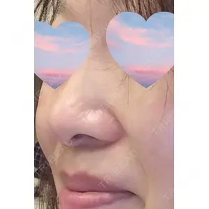 口コミ