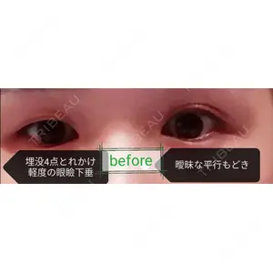 口コミ
