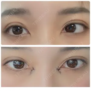 TCB東京中央美容外科 TCB東京中央美容外科 心斎橋筋院口コミ