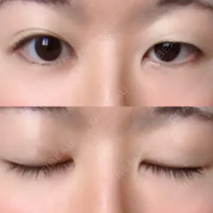 口コミ