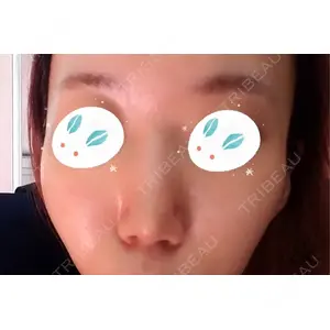 HANABI整形外科口コミ