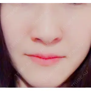 リッツ美容外科の口コミ