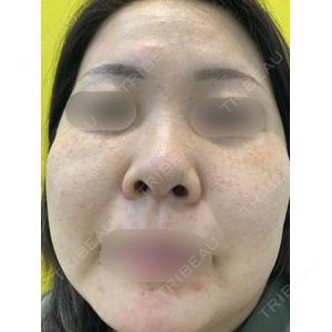 有楽町美容外科クリニック口コミ