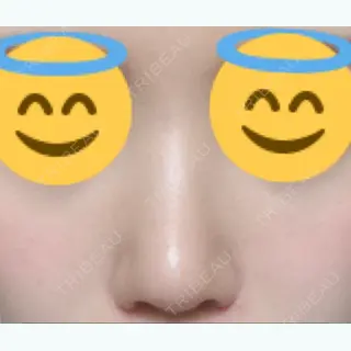 107日目の経過画像（1枚目）