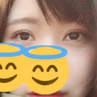 43日目の経過画像（1枚目）