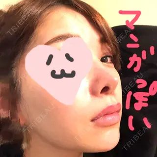 11日目の経過画像（3枚目）