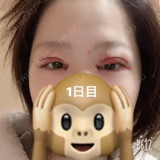 1日目の経過画像（1枚目）
