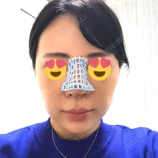 2日目の経過画像（1枚目）