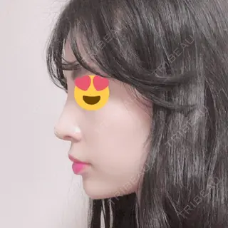 10日目の経過画像（3枚目）