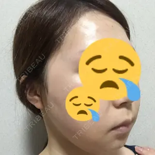 7日目の経過画像（2枚目）