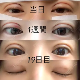 19日目の経過画像（1枚目）