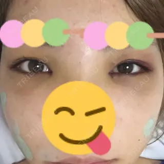2日目の経過画像（1枚目）