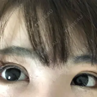 62日目の経過画像（1枚目）