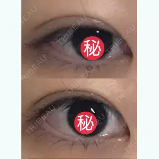 25日目の経過画像（3枚目）