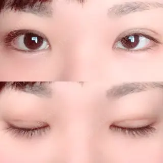 8日目の経過画像（1枚目）