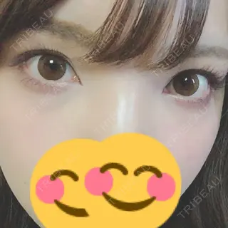 40日目の経過画像（1枚目）