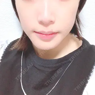 31日目の経過画像（1枚目）