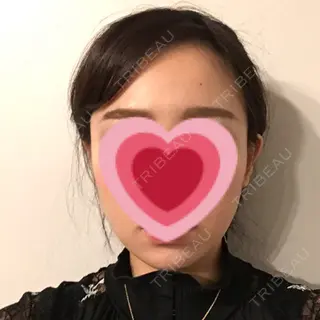 28日目の経過画像（1枚目）