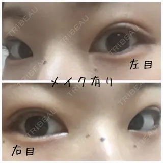 10日目の経過画像（2枚目）