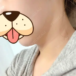 3日目の経過画像（3枚目）