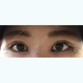 1日目の経過画像（3枚目）