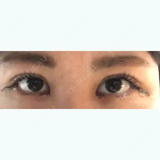 3日目の経過画像（3枚目）