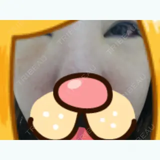 8日目の経過画像（2枚目）