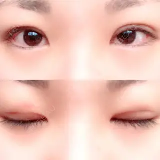10日目の経過画像（1枚目）