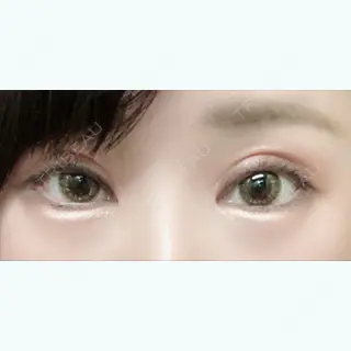 25日目の経過画像（1枚目）