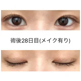27日目の経過画像（2枚目）