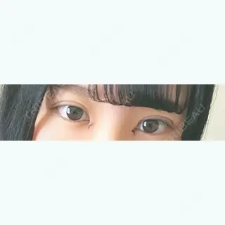 3日目の経過画像（1枚目）