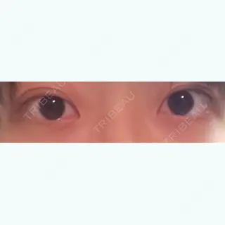 12日目の経過画像（1枚目）