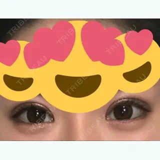 14日目の経過画像（1枚目）
